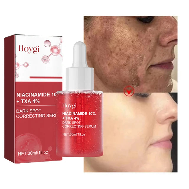 Sérum Facial Uniformizador – 10% Niacinamida + 4% Ácido Tranexâmico | Clareia Manchas de Acne e Uniformiza o Tom da Pele ✨