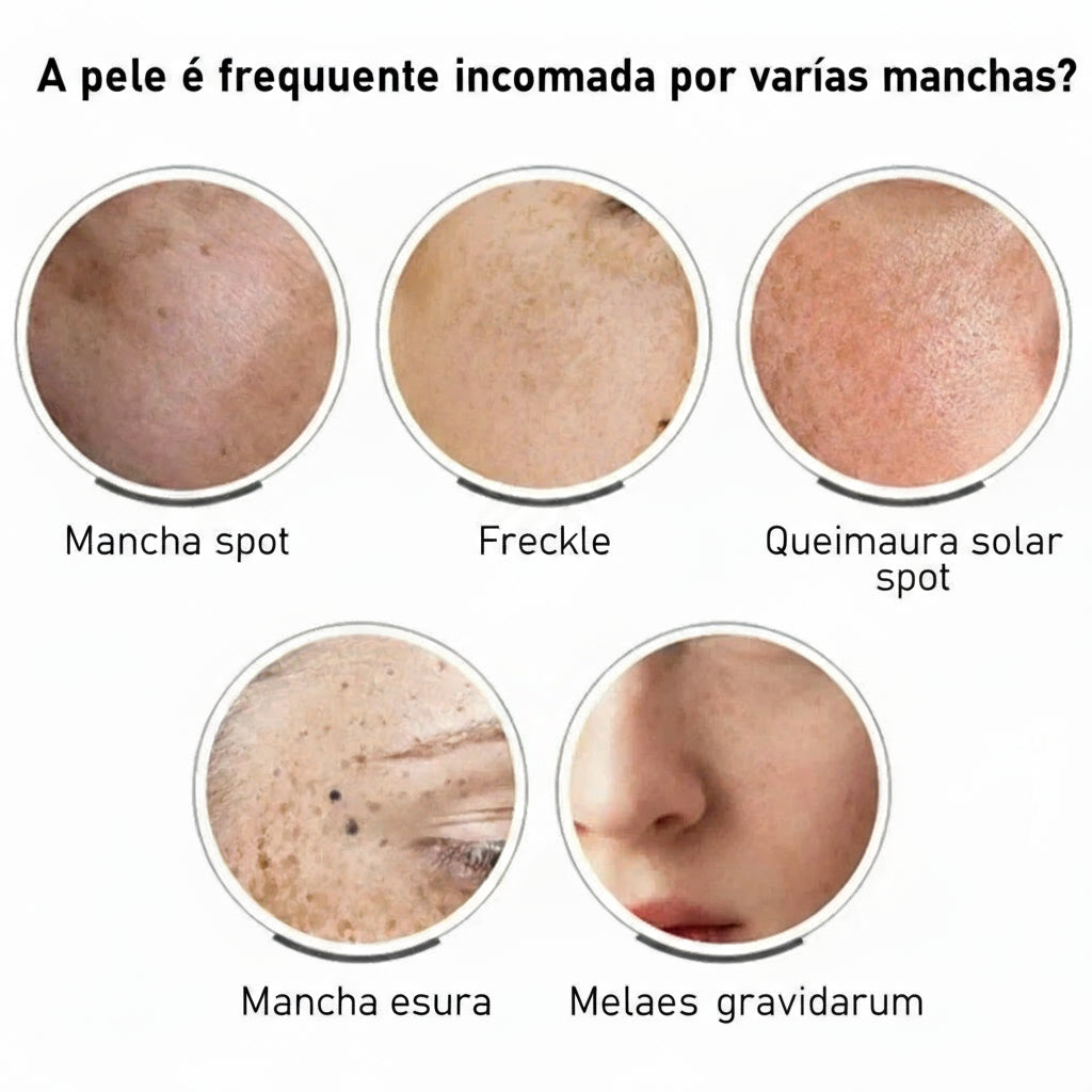 Creme Clareador com Niacinamida | Reduz Melasma, Clareia a Pele e Suaviza Linhas Finas 💆♀️