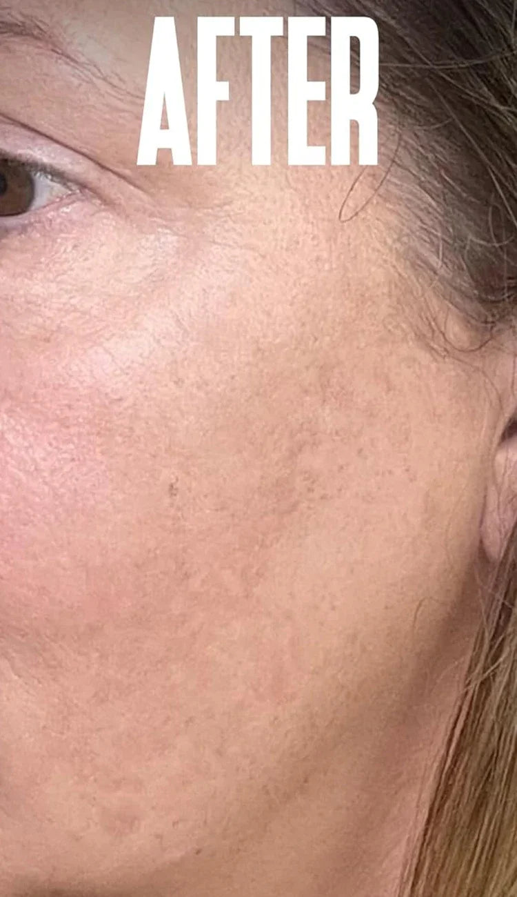 Creme Clareador com Niacinamida | Reduz Melasma, Clareia a Pele e Suaviza Linhas Finas 💆♀️