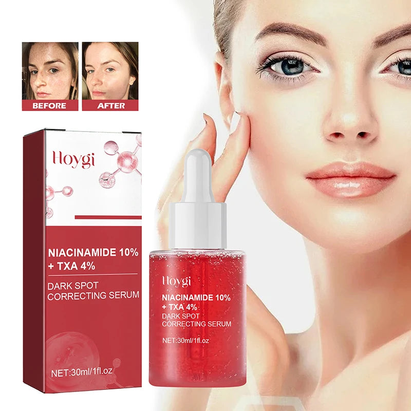 Sérum Facial Uniformizador – 10% Niacinamida + 4% Ácido Tranexâmico | Clareia Manchas de Acne e Uniformiza o Tom da Pele ✨