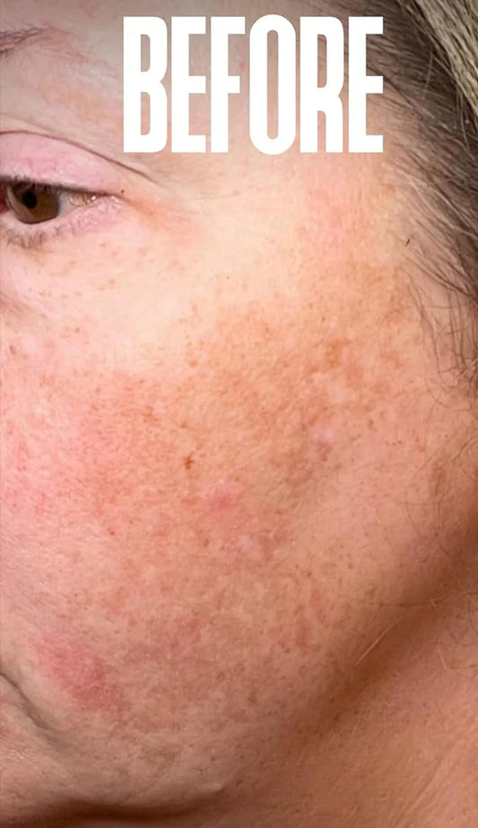 Creme Clareador com Niacinamida | Reduz Melasma, Clareia a Pele e Suaviza Linhas Finas 💆‍♀️