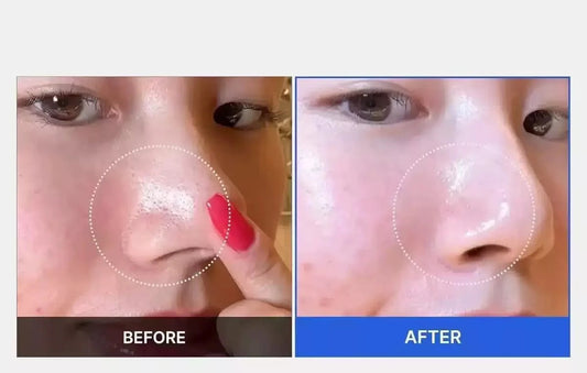 Pads de Limpeza Medicube com Ácido Salicílico | Limpeza Profunda e Hidratação em Um Só Passo 💧