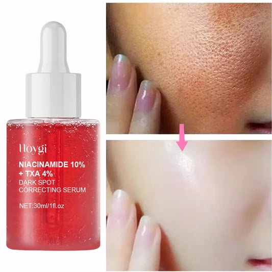 Sérum Facial Uniformizador – 10% Niacinamida + 4% Ácido Tranexâmico | Clareia Manchas de Acne e Uniformiza o Tom da Pele ✨